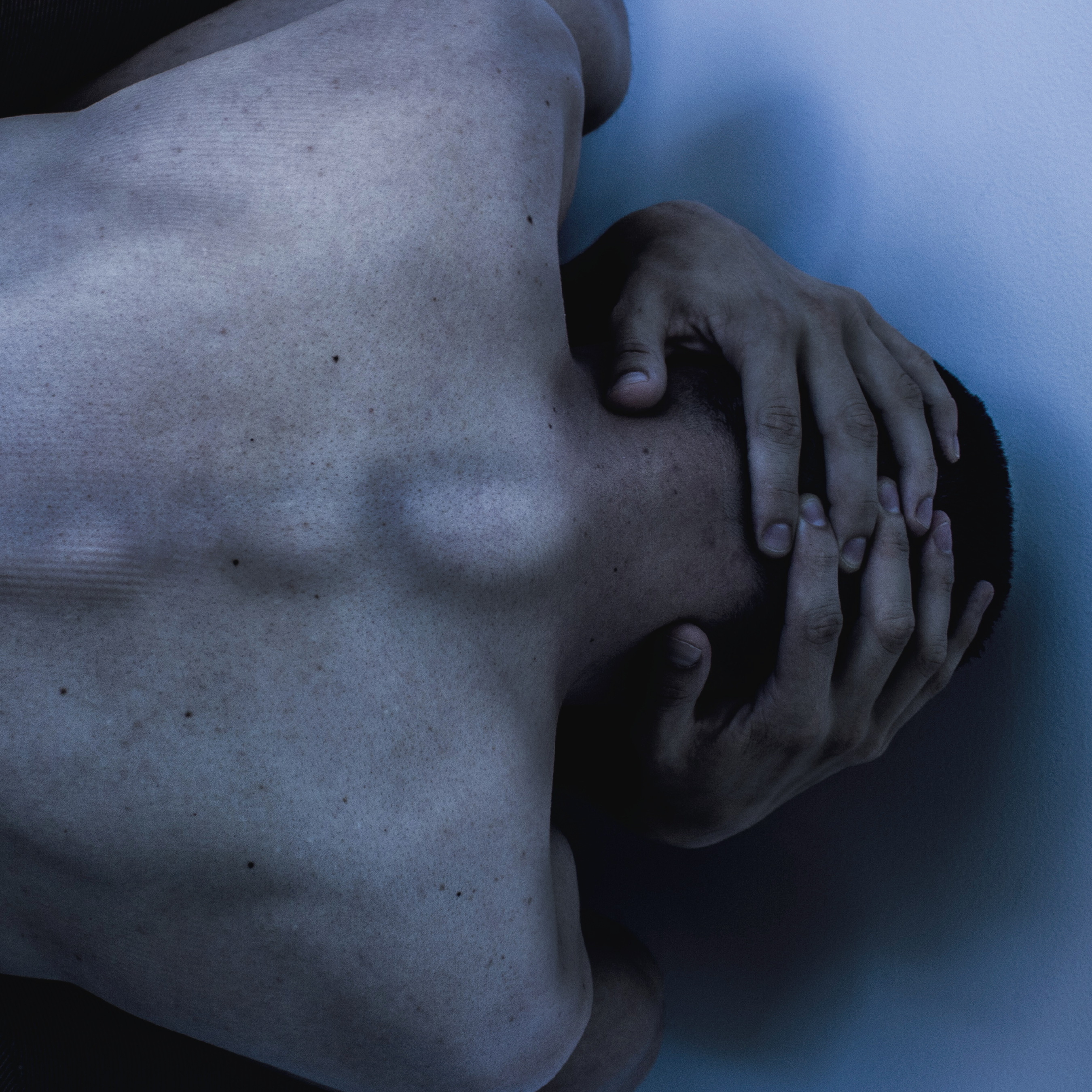 Anorexia y Bulimia